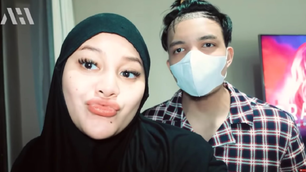 Potret Terbaru Atta Halilintar Setelah Transplantasi Rambut (YouTube/AH)