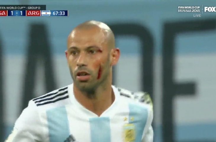 Mascherano berdarah Twitter.com/@sportingnews