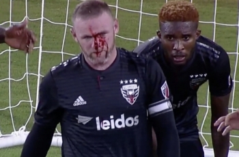 Wayne Rooney Patah Hidung Saat Debut Bersama DC United