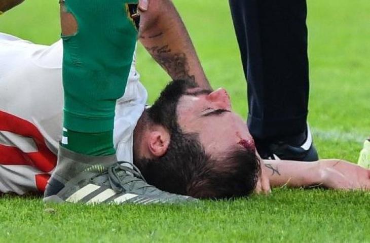 Pemain depan Juventus, Gonzalo Higuain bertabrakan dengan kiper Lecce, Gabriel pada pertandingan sepak bola Serie A Italia di Stadio Comunlae Via del Mare, Lecce, Sabtu (27/10). [Alberto PIZZOLI / AFP]