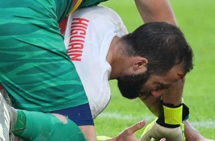 Pemain depan Juventus, Gonzalo Higuain bertabrakan dengan kiper Lecce, Gabriel pada pertandingan sepak bola Serie A Italia di Stadio Comunlae Via del Mare, Lecce, Sabtu (27/10). [Alberto PIZZOLI / AFP]