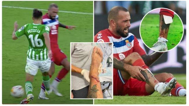 Pemain Espanyol, Aleix Vidal mengalami cedera robek kulit kaki karena hanya memakai deker setipis karton. [SportBibble]