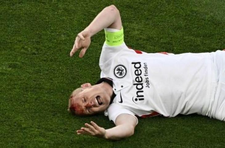 Momen Sebastian Rode alami cedera kepala akibat tendangan pemain Rangers. (AFP)