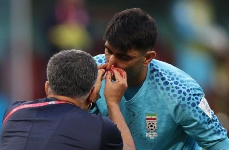 Kiper Iran, Alireza Beiranvand mengalami cedera saat menghadapi Inggris di matchday pertama Grup B Piala Dunia 2022. (Adrian DENNIS / AFP)